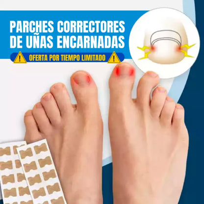 Parches Anti-Hongos | Regenerador de Uñas - 10UN