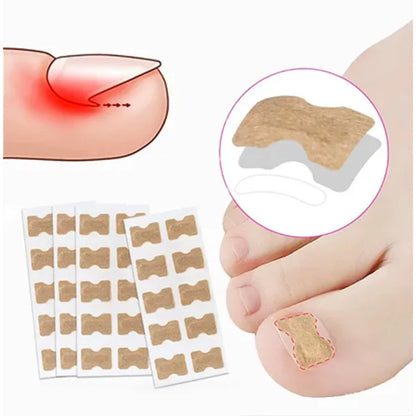 Parches Anti-Hongos | Regenerador de Uñas - 10UN