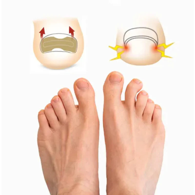 Parches Anti-Hongos | Regenerador de Uñas - 10UN