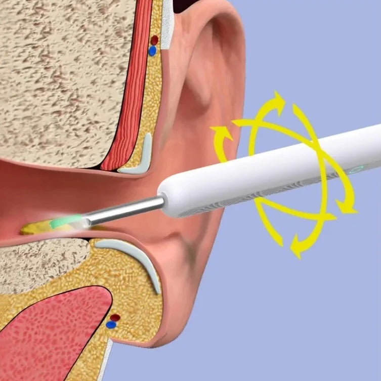 Otoscopio Ear Pro® - Control total para una limpieza de oídos más segura