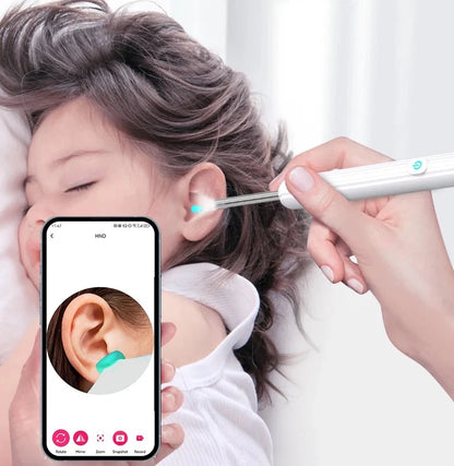 Otoscopio Ear Pro® - Control total para una limpieza de oídos más segura