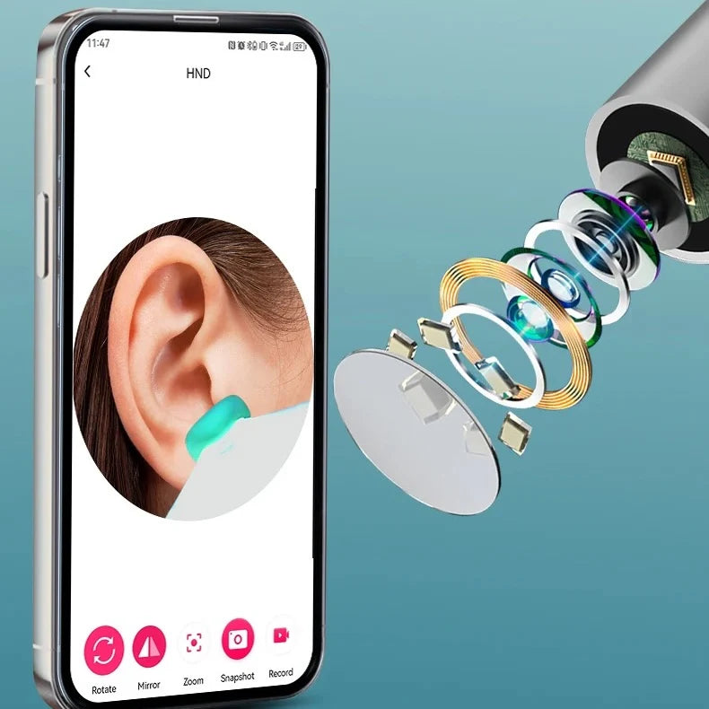 Otoscopio Ear Pro® - Control total para una limpieza de oídos más segura