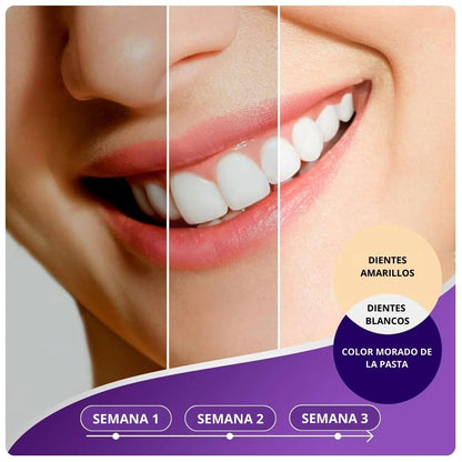 Pasta Dental Blanqueadora V34 - Neutralizador de Manchas - 50ML